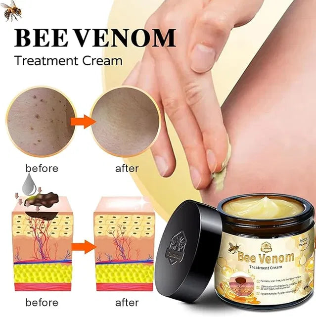 Bee Venom Vitigo Correcting Cream - (Pack of 2)