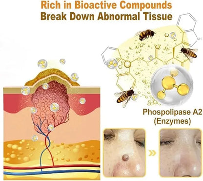 Bee Venom Vitigo Correcting Cream - (Pack of 2)