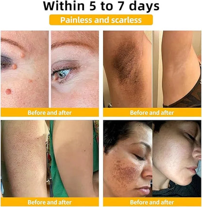 Bee Venom Vitigo Correcting Cream - (Pack of 2)