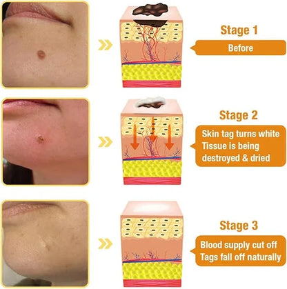 Bee Venom Vitigo Correcting Cream - (Pack of 2)